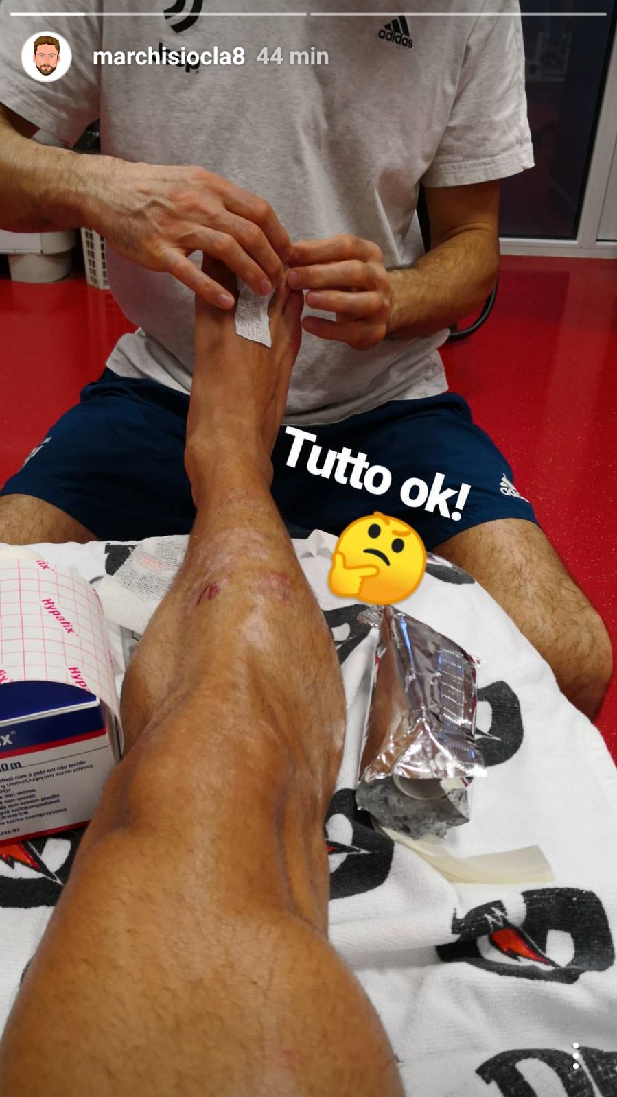 Marchisio, ma cosa ti sei fatto al piede!? - FOTO 39 WhatsApp Image 2018 02 03 at 18.24.19