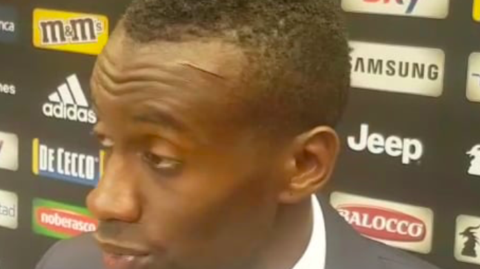 Matuidi al top, le sue parole post Juventus-Lazio - VIDEO 36 matuidi