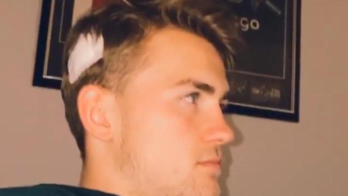 De Ligt incerottato dopo il taglio di Lione-Juve - FOTO 36 de ligt instagram 1