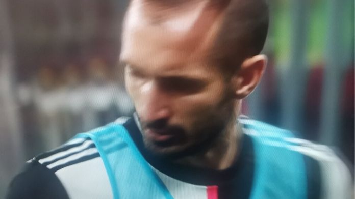 Milan-Juve, Leao ribalta la sfida: Chiellini reagisce così in panchina - FOTO 36 Chiellini 1