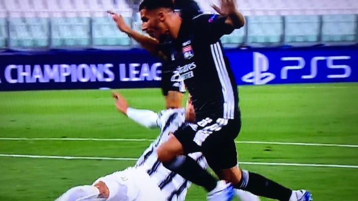 Moviola Juve-Lione: i quotidiani bocciano pesantemente Zwayer 36 Rigore Lione