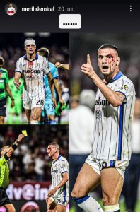 Demiral furioso e incredulo: «Ho preso un giallo dopo questo» - FOTO 39 WhatsApp Image 2021 09 18 at 23.35.38