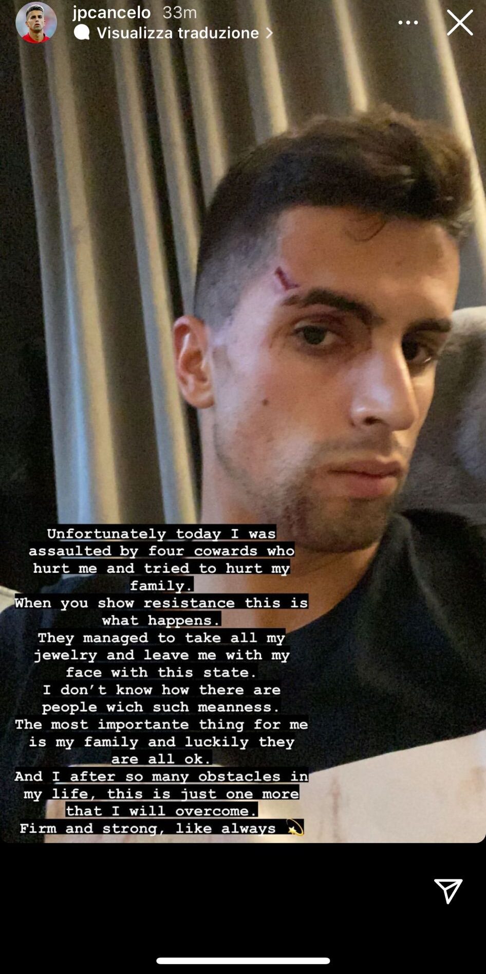 Cancelo, paura in casa per l'ex Juve. La ricostruzione dell'accaduto 39 cancelo e1640942756549