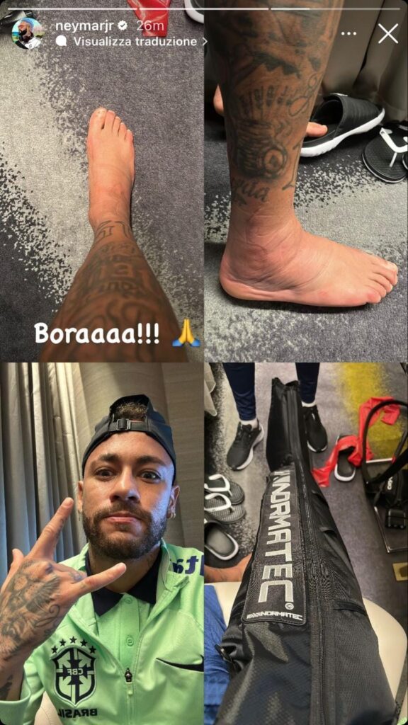 Neymar punta già al recupero, ma la caviglia fa paura! - FOTO 37 Neymar