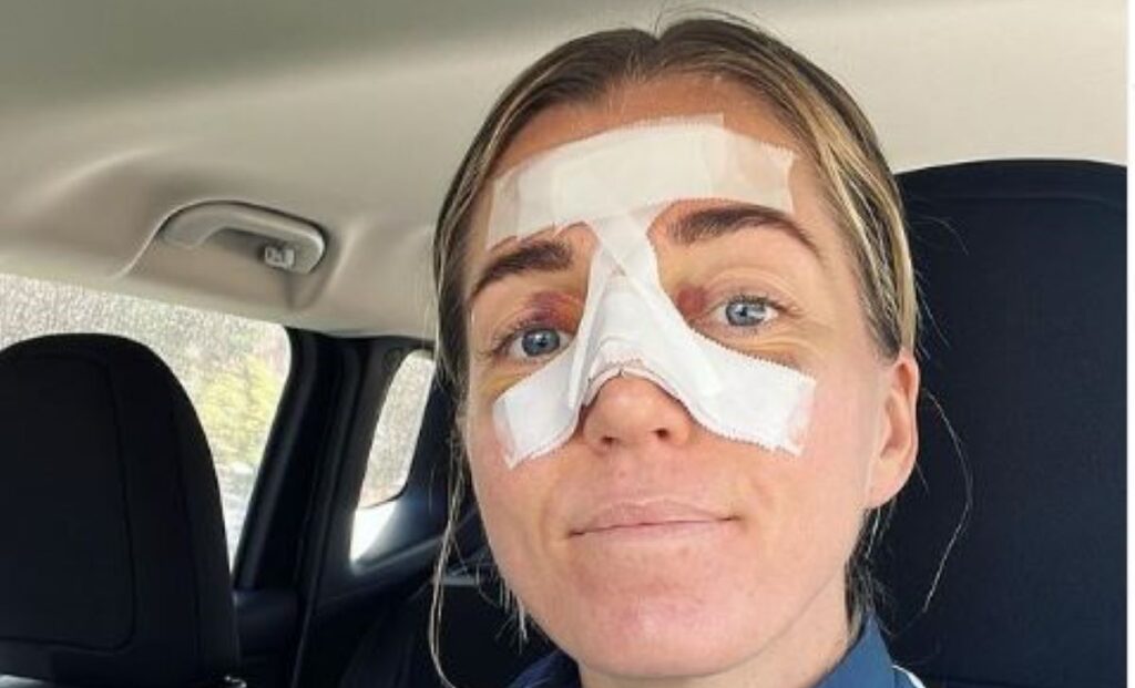 Protezione Naso Per Sport - Maschera Facciale Regolabile, PP Infrangibile, Per Basket/Calcio - Foto 10