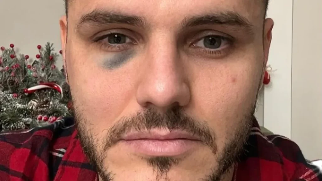 Icardi