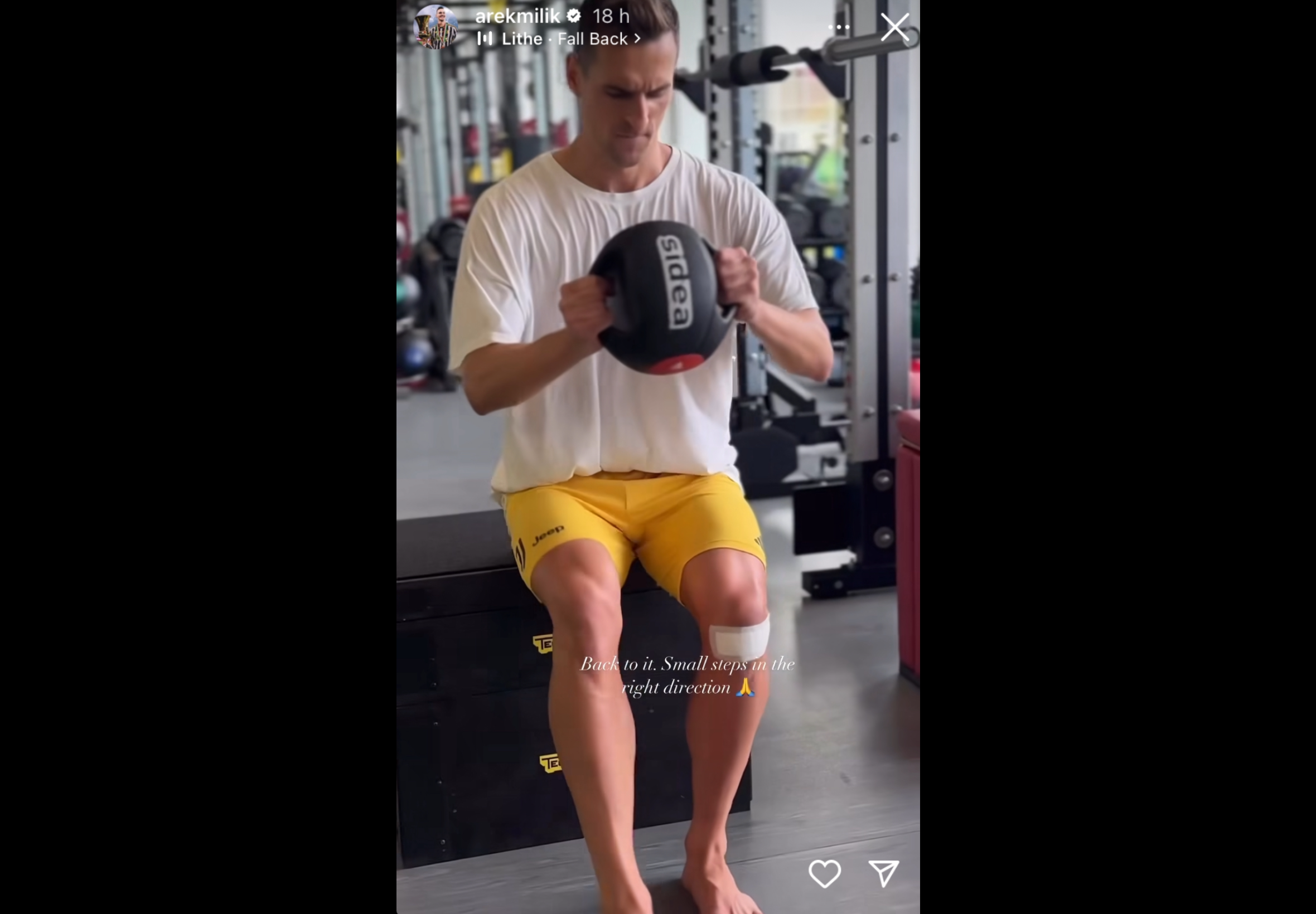 Infortunio Milik, l’attaccante è già al LAVORO alla Continassa! FOTO 36 Milik