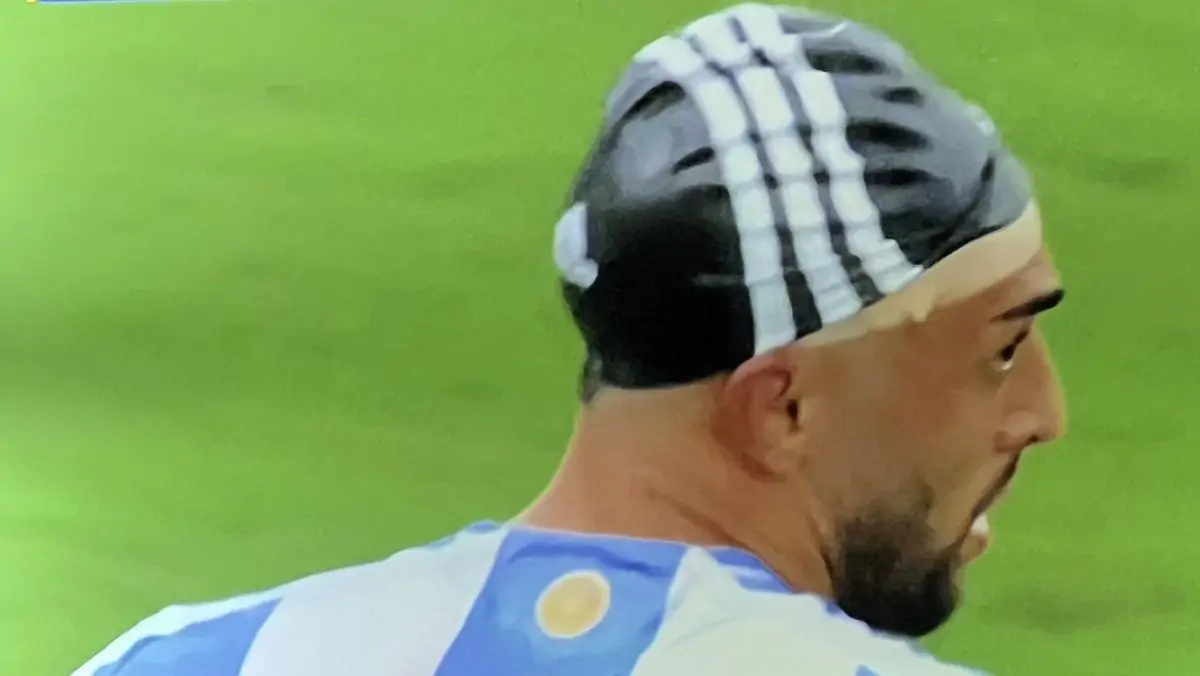 Nico Gonzalez Argentina, 90 minuti, il gol e NON SOLO: lo juventino finisce con una FASCIATURA alla testa. Il MOTIVO 36 Nico Gonzalez