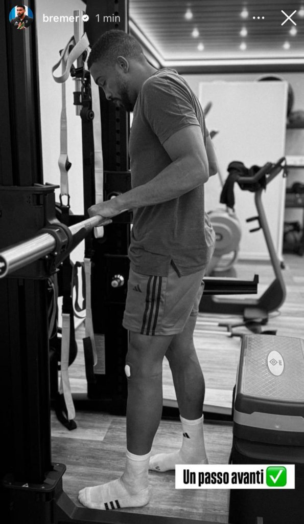 Infortunio Bremer, il brasiliano ha già in mente il ritorno in campo: «Un passo avanti». Ha aggiornato così i tifosi sulle sue condizioni - FOTO 37 bremer 1