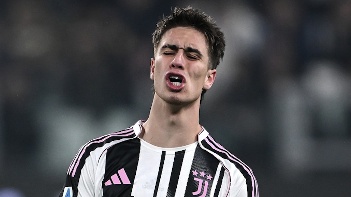 Yildiz come Pogba: con il rigore contro l’Udinese il turco eguaglia l’ex centrocampista della Juventus! Il dato che salta all’occhio