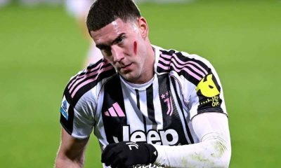 Spalletti non aiuta la Juve