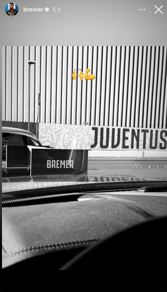 Bremer alla Continassa: il brasiliano della Juve conta i giorni che lo separano dal rientro - FOTO 37 bremer 1